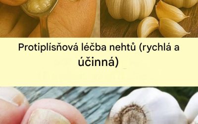 Česnek, přírodní lék na infekce nehtů: jak ho používat