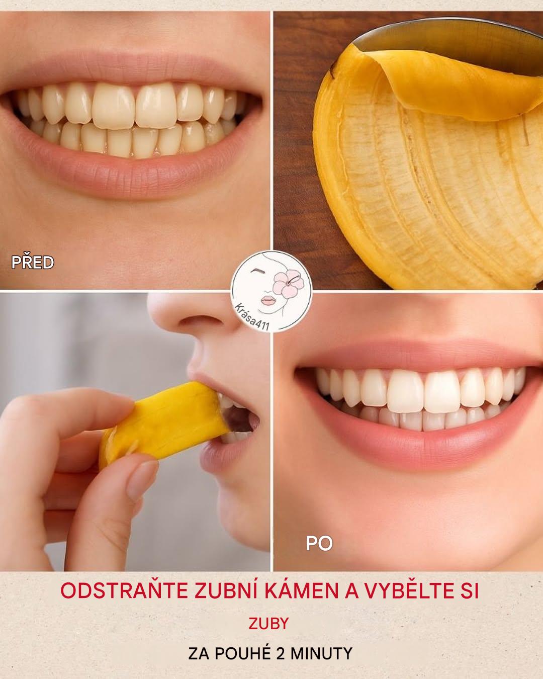 Odhalena nečekaná tajemství banánových slupek