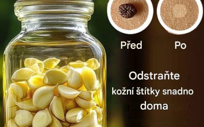 3 přírodní prostředky, jak se zbavit drobných kožních výrůstků