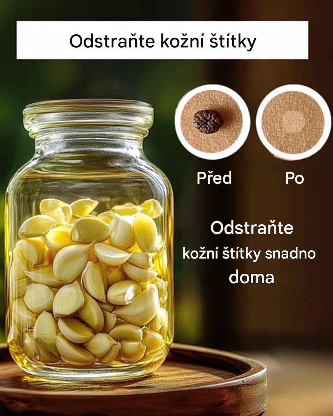 3 přírodní prostředky, jak se zbavit drobných kožních výrůstků