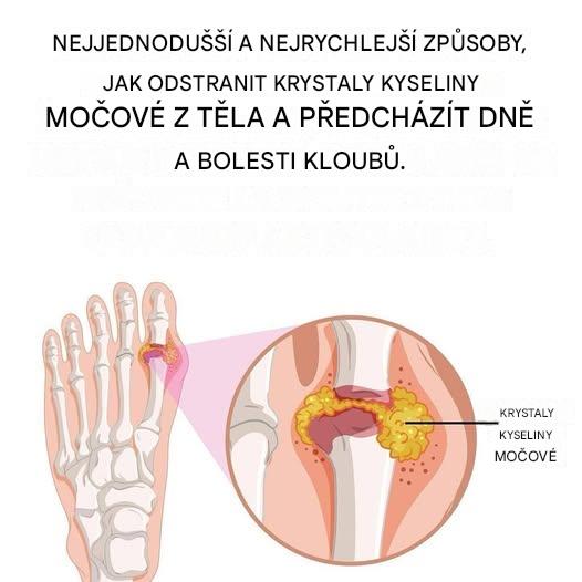 Účinné přírodní léky na bolest dny a zánět kloubů