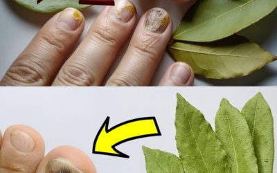 Ošetřete si plísňové nehty, aniž byste museli utratit majlant: 100% přírodní lék s bobkovým listem