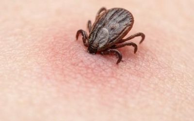 Lymská borelióza: oddělování faktů od fikce pro sebevědomí a užívání si přírody