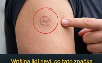 Kulatá jizva na paži: co to znamená?