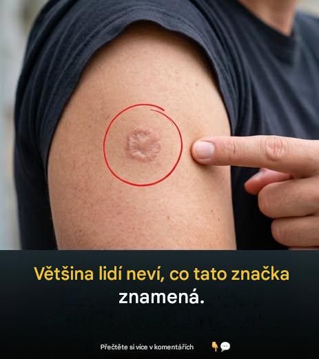 Kulatá jizva na paži: co to znamená?