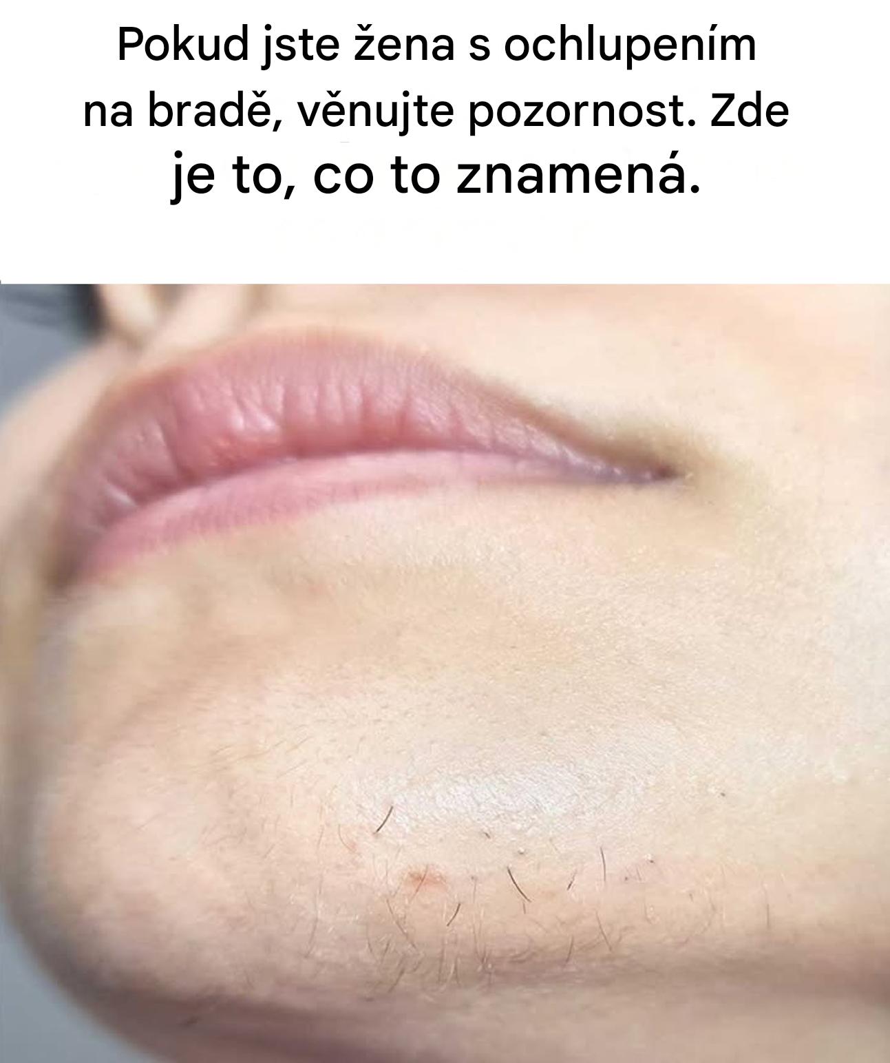Ženská brada a nečekaný růst ochlupení: co se vám vaše tělo možná snaží říct