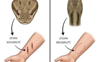 Co dělat po uštknutí hadem: základní kroky první pomoci, které mohou znamenat velký rozdíl