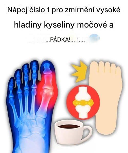 „Můj palec na noze hořel, dokud jsem neobjevila těchto 5 nápojů, které přirozeně odstraňují kyselinu močovou.“