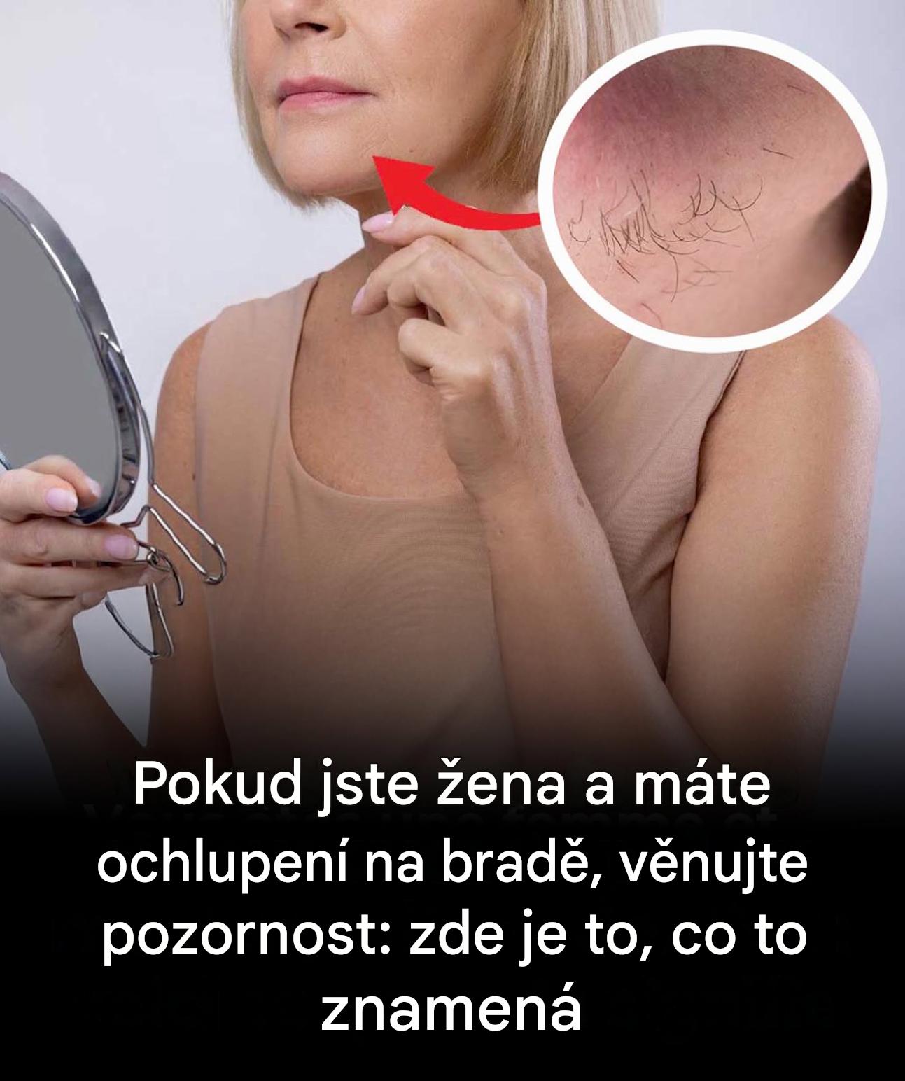 Brada, knír nebo broskvové chlupy: dekódování nečekaného ochlupení na ženském těle