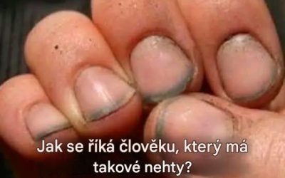 Jak se říká člověku, který má takové nehty?