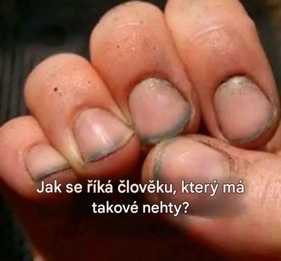 Jak se říká člověku, který má takové nehty?