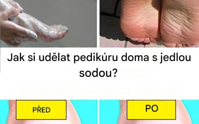 Dopřejte si pedikúru jako z lázní s kuchyňskou ingrediencí: jedlou sodou.