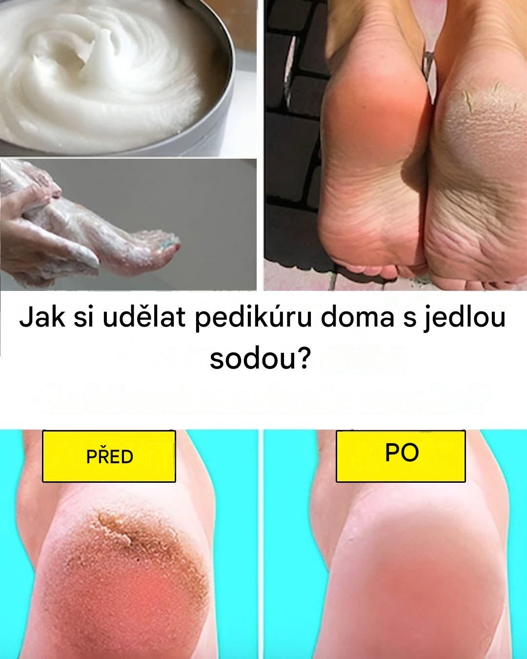 Dopřejte si pedikúru jako z lázní s kuchyňskou ingrediencí: jedlou sodou.