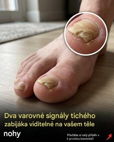 Dvě tiché nemoci, které mohou vaše nohy odhalit: příznaky, na které si dát pozor a kdy navštívit lékaře
