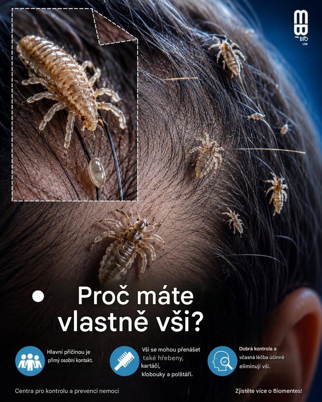 Vši v hlavě u dětí