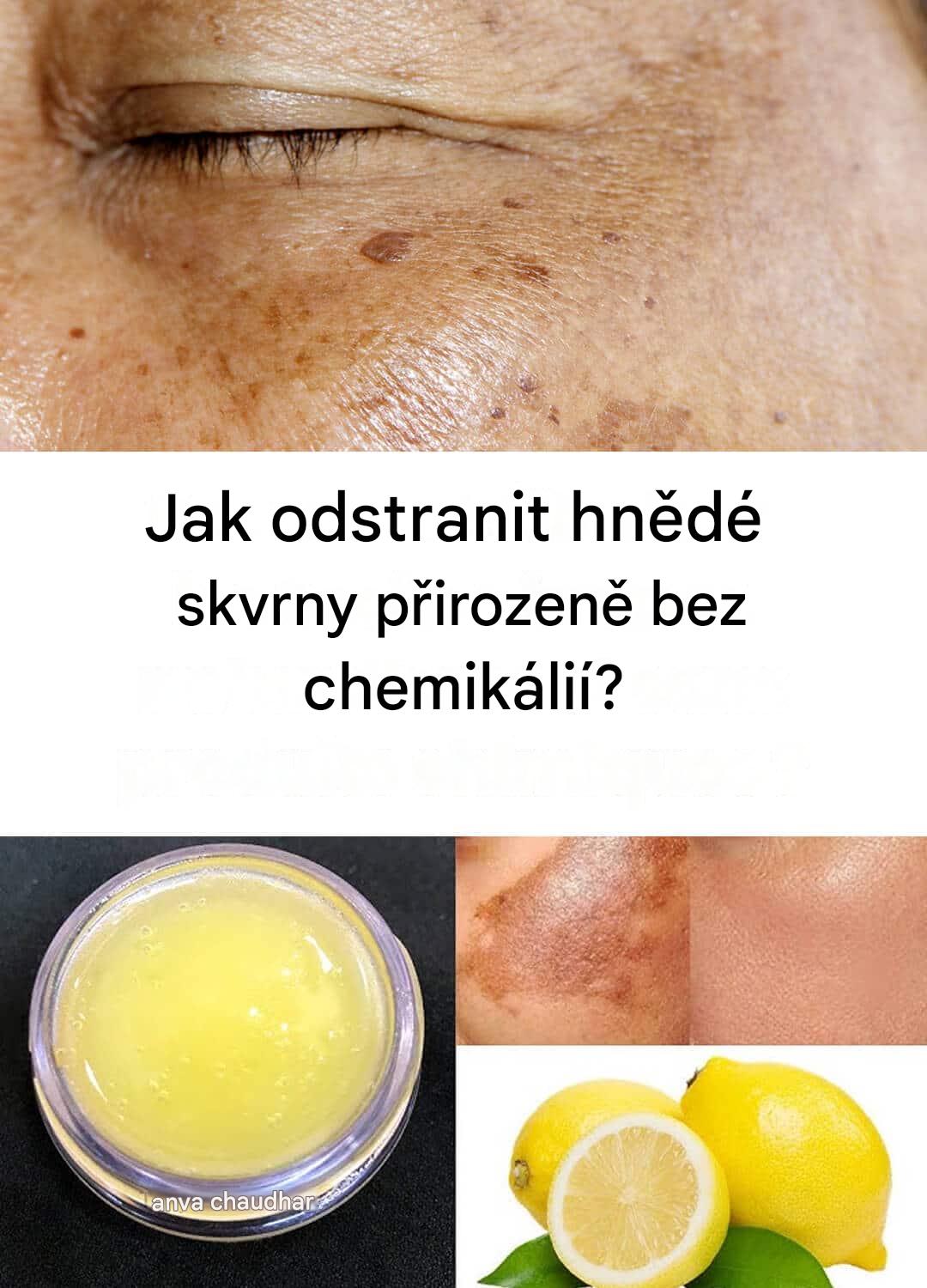 Přírodní tipy pro bezchybnou pleť