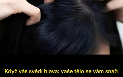 Svědivá pokožka hlavy: jaké signály vám vaše tělo vysílá?
