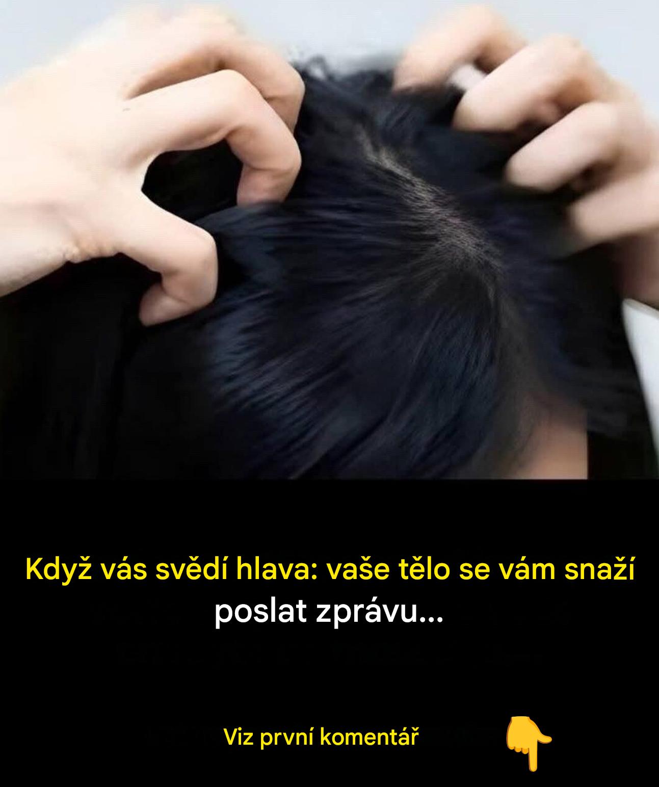 Svědivá pokožka hlavy: jaké signály vám vaše tělo vysílá?