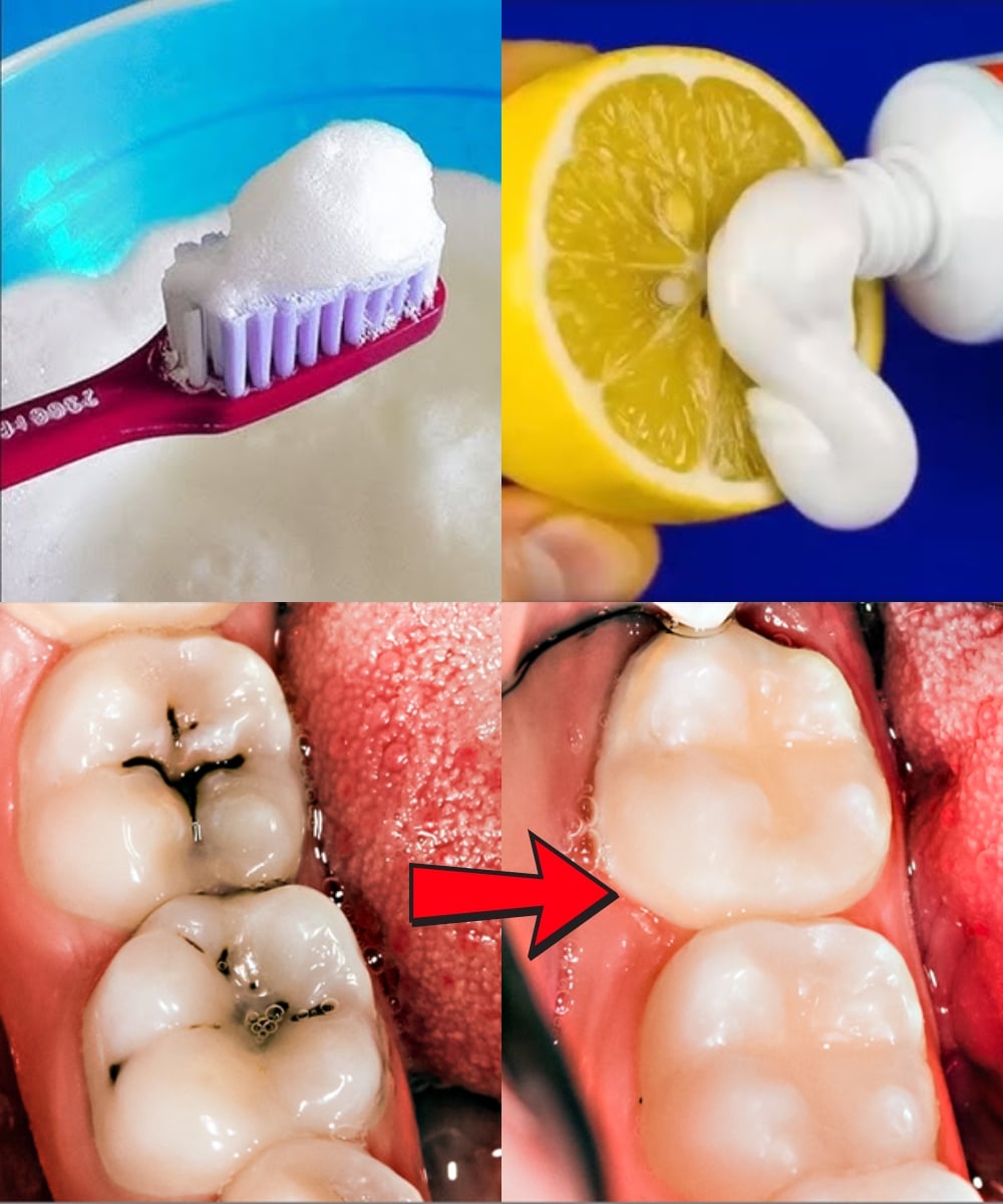 Přírodní tipy pro optimální zdraví zubů: účinná prevence zubního kazu