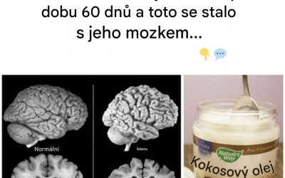 Nečekané přínosy kokosového oleje pro paměť a intelekt