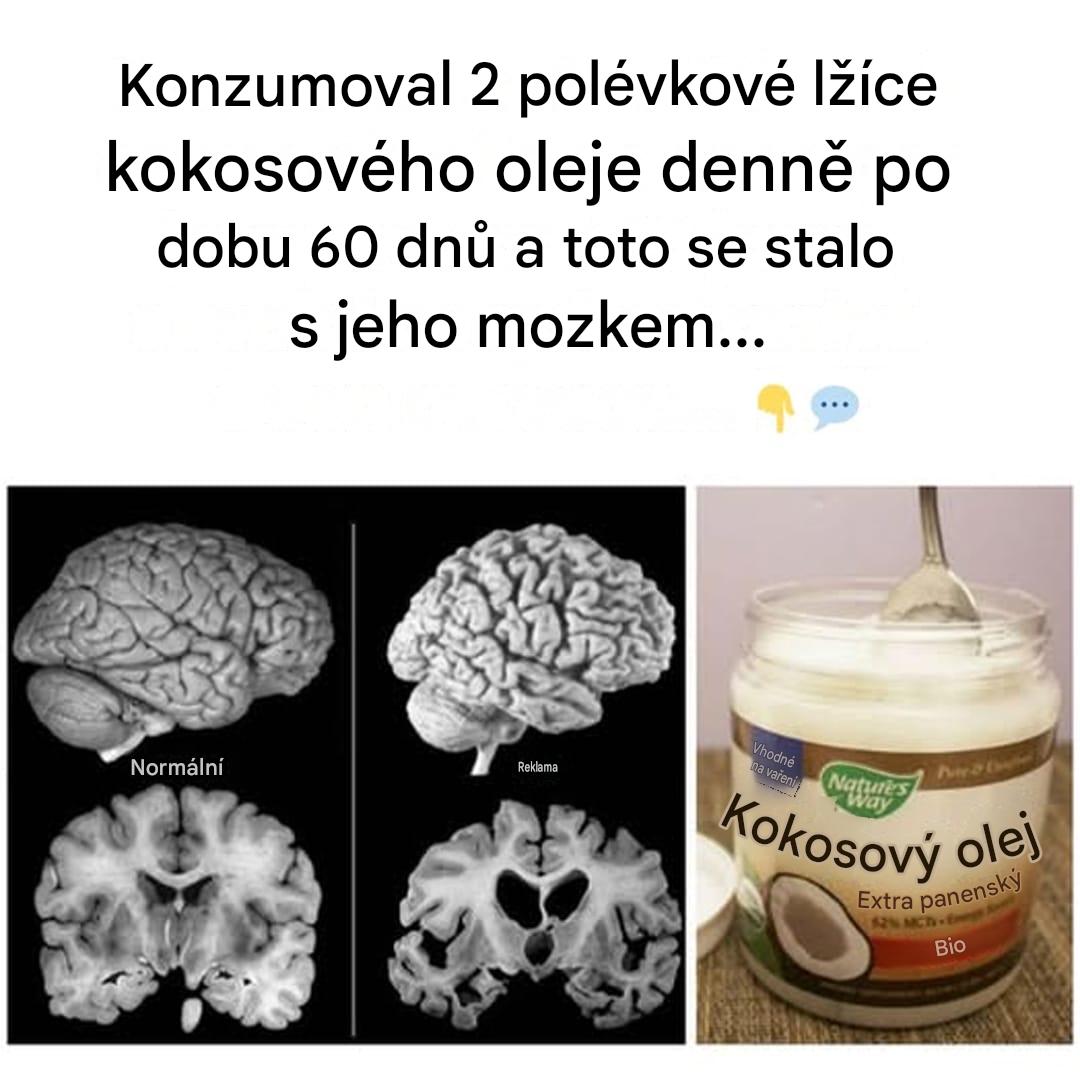 Nečekané přínosy kokosového oleje pro paměť a intelekt